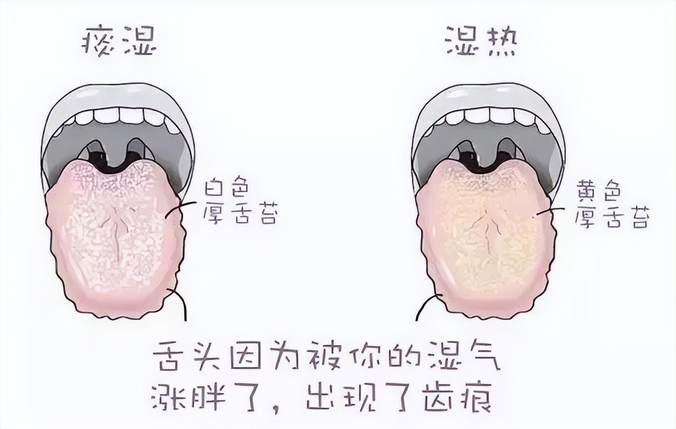 先调脾胃还是先去湿气呢，女性脾胃不好七大表现