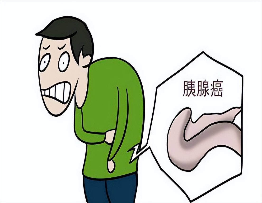 什么叫新发糖尿病,新发糖尿病的诊断标准 什么叫新发糖尿病,新发糖尿病的诊断标准