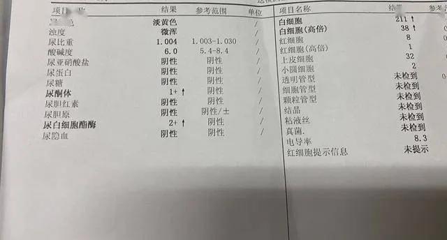 尿常规能检查出什么性疾病,男性验尿能检查出什么 尿常规能检查出什么性疾病,男性验尿能检查出什么